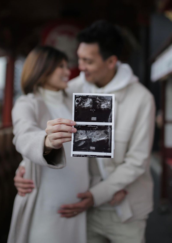 Scottie Thompson and wife Jinky showing a sonogram